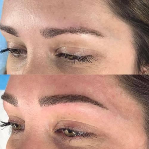 kyndra-microblading-before-and-after-e1490398715127